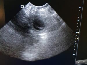 Scan Picture 1