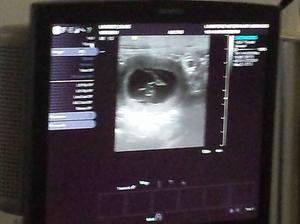 Confirmed scan