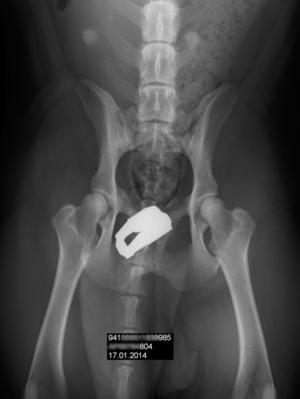 ezmais hip score xrays