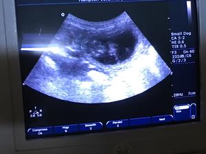 Scan at 5 weeks
