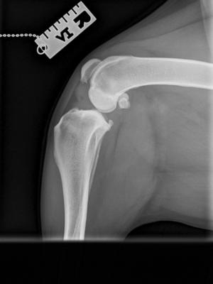 X Ray of Ziva's progress following 6 week check-up
