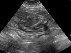 puppy scan. due DOB 21/04.18