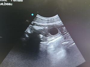 Scanned for 8 babies