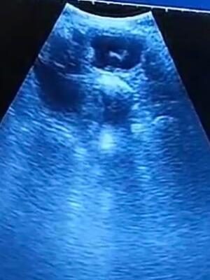30 Day Scan