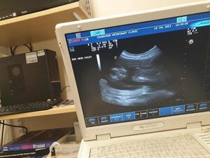 Pregnancy confirmed by ultrasound