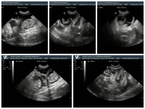 ULTRASOUND PICTURES 09/08/2015