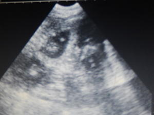 Scan of a litter of pups