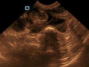 Typical Scan image