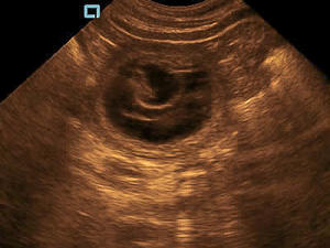 Typical Ultrasound Scan