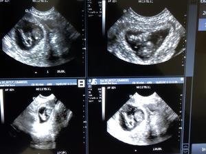 Cocker Spaniel - 34 days gestation