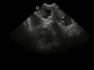 Ultrasound Scan